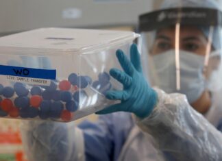 सैंपल लेते ही मोबाइल नंबर भी जांचेंगी टीम, गलत या सही का तुरंत लगेगा पता