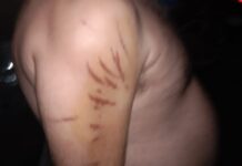 शिवसेना टकसाली के प्रधान राजन राणा के साथ हुई मारपीट