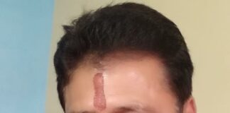 कोरोना मृतकों के शव आटो व रेहडे मे शमशान घाट लाने पर COVID-19 नियमो की पालना क्यो नही?? जाँच करवाई जाये : योगेश बखशी