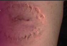 ਪਿਓ ਨੇ ਹੀ ਆਪਣੀ ਧੀ ਦਾ ਕੀਤਾ ਬਲਾਤਕਾਰ , 4 ਸਾਲਾਂ ਤੋਂ ਕੈਦ ਰੱਖਿਆ ਘਰ ਵਿਚ , ਦੰਦ ਮਾਰ-ਮਾਰ ਕੀਤਾ ਸਰੀਰ ਜਖਮੀ