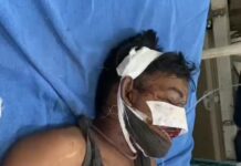 लुधियाना तेज आंधी की आफतपेड़,खंबा गिरने से 2 घायल, होंठ और गाल पर लगे 50 टांके, महिला के सिर में लगी ईंट